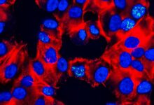 Photo of Медицинская наука: новые методы борьбы с раком