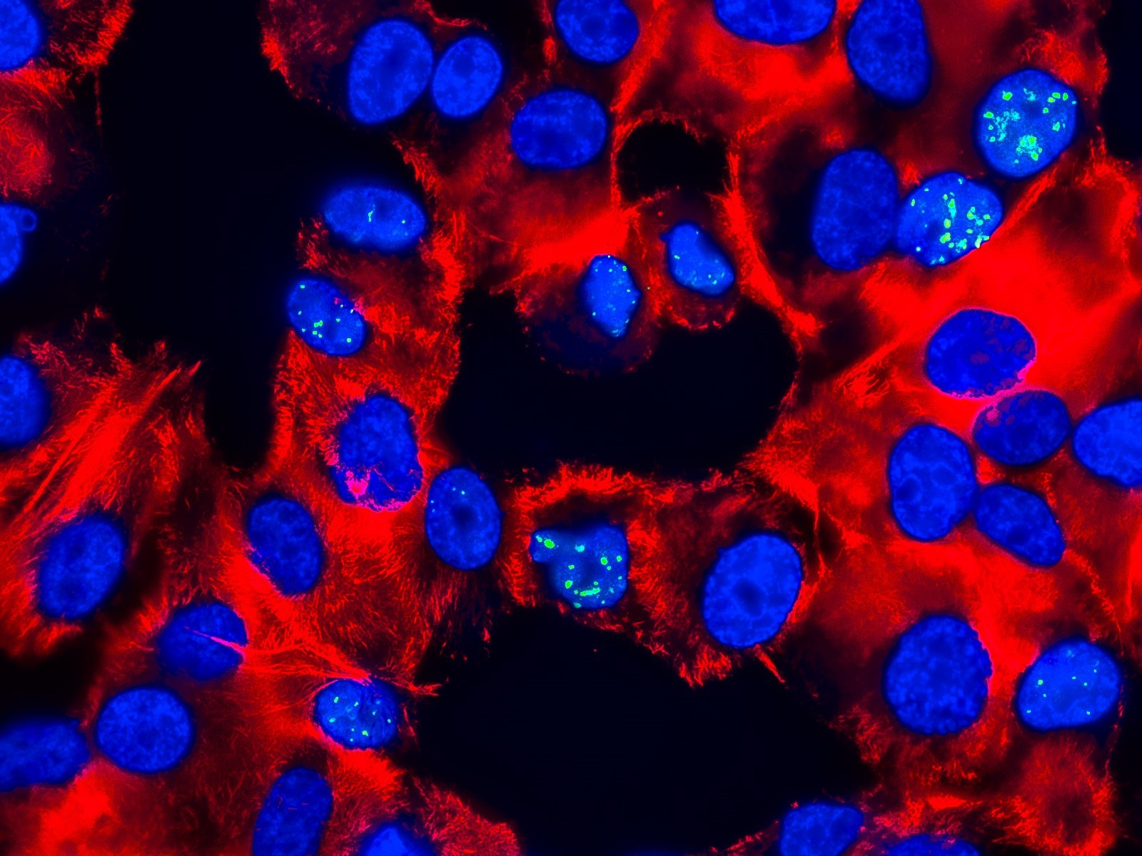 Фото 5 — Медицинская наука: новые методы борьбы с раком